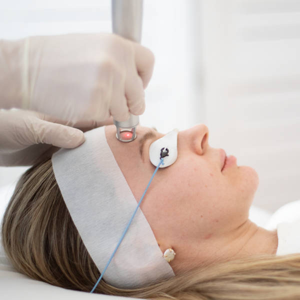 Laser treatment for acne.