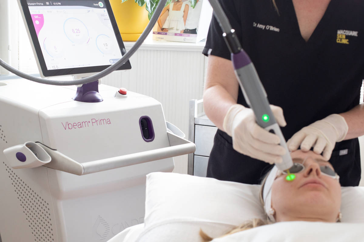 Woman receiving laser treatment with the Vbeam Prima.